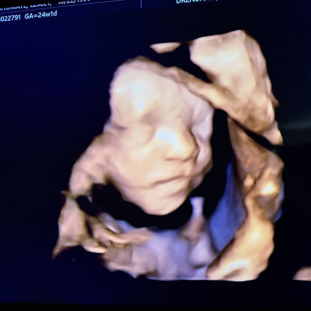 Photo shared by Lesley for their Babylist baby registry.