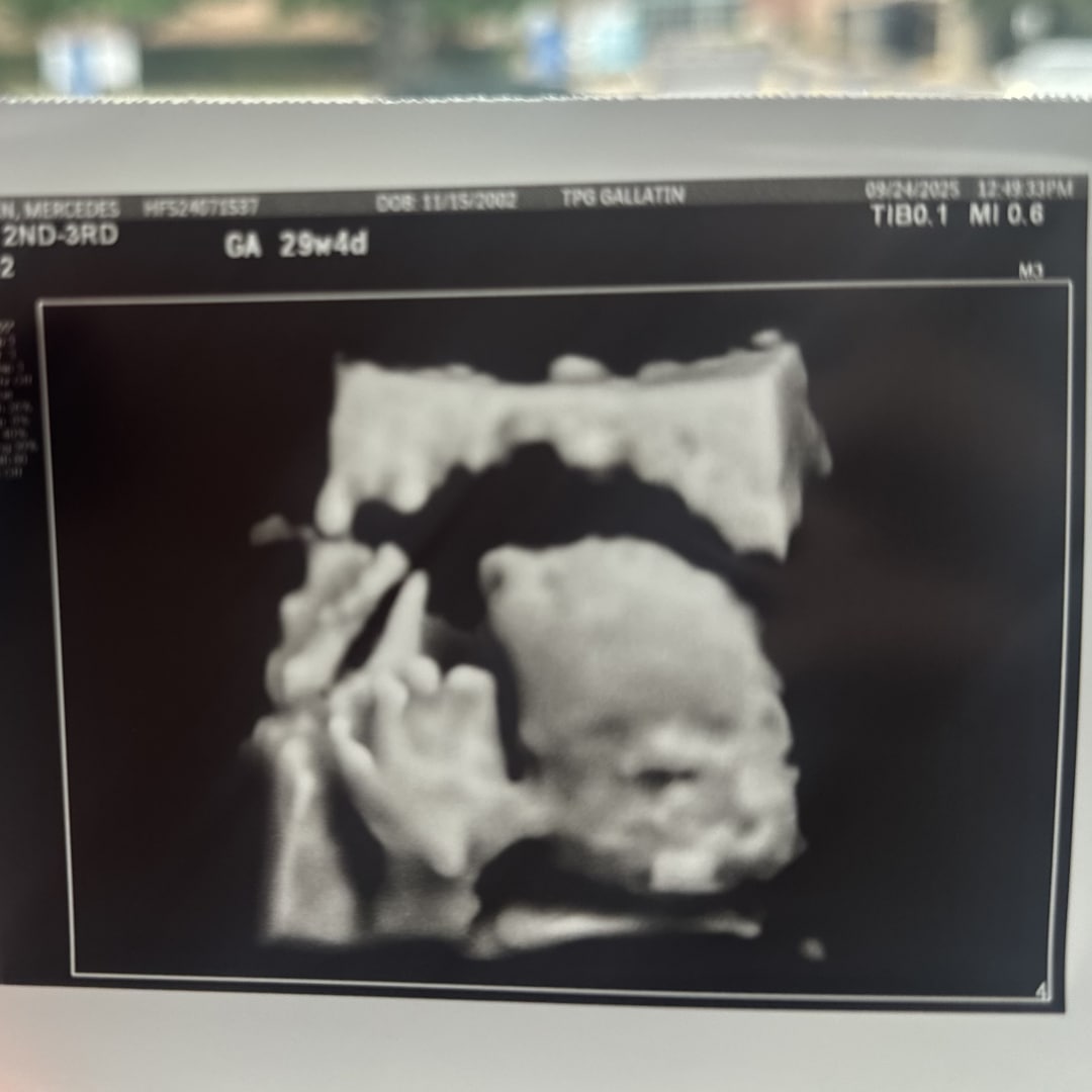 Photo shared by Mercedes for their Babylist baby registry.