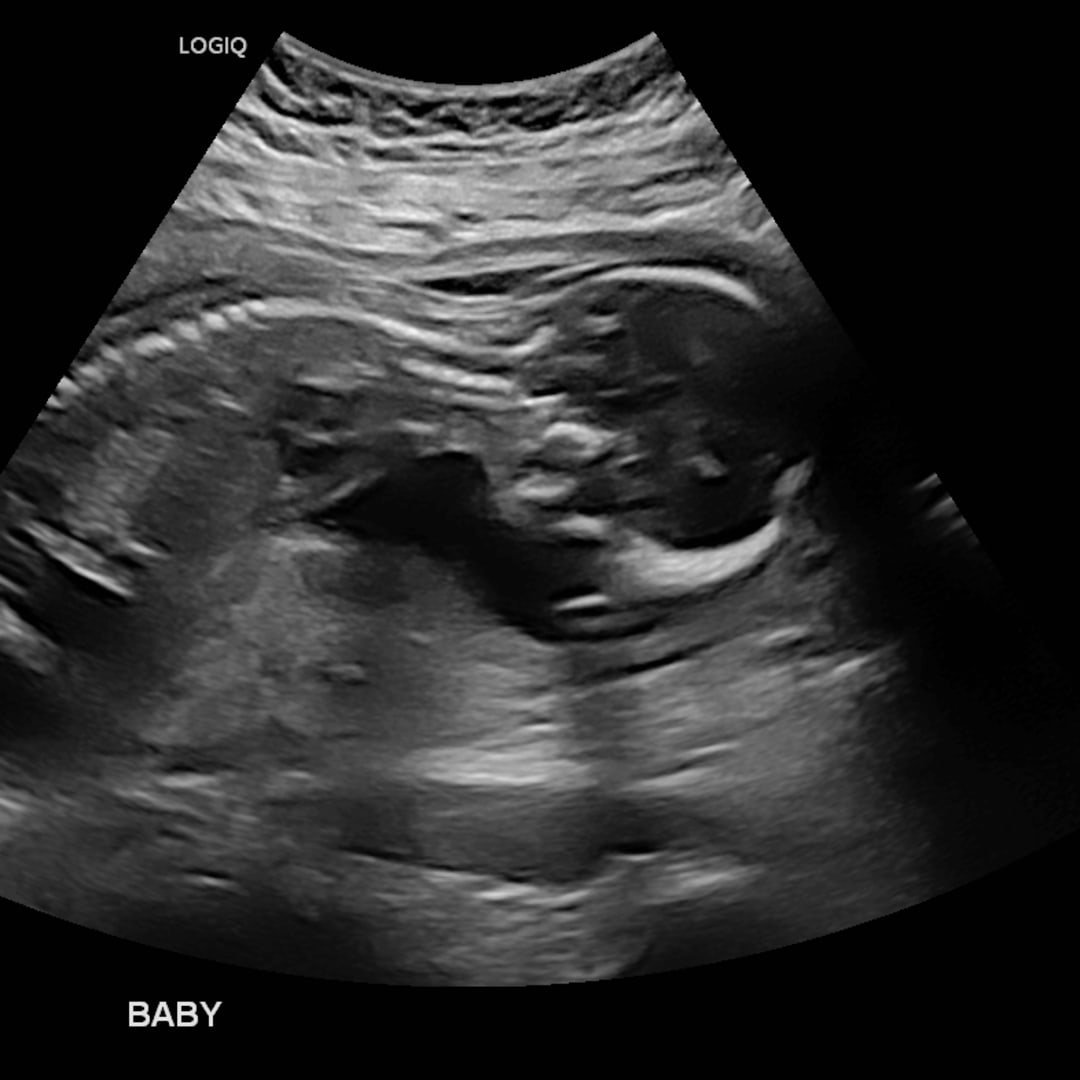 Photo shared by Esmeralda for their Babylist baby registry.