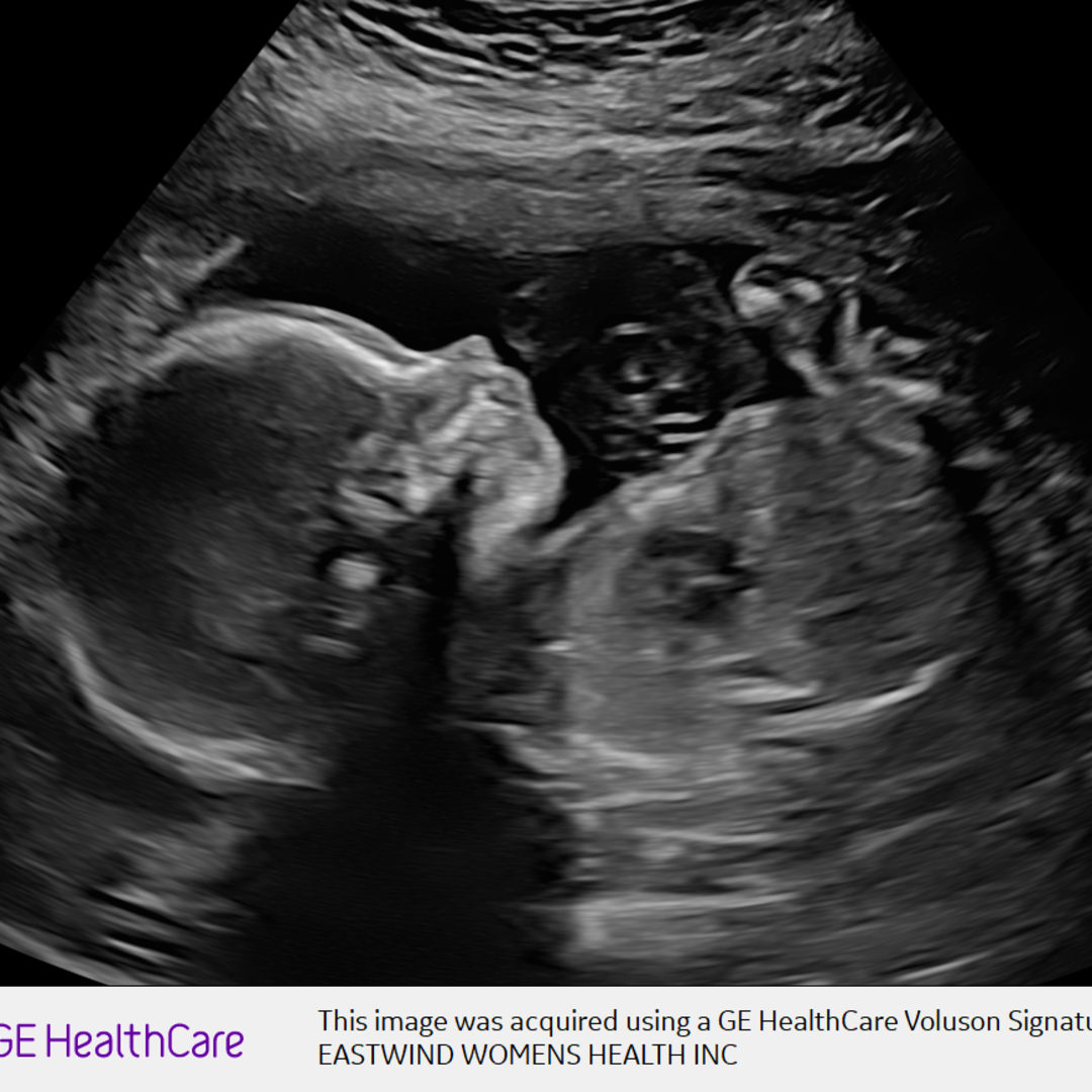 Photo shared by Savannah for their Babylist baby registry.