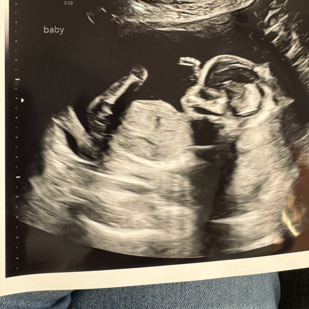 Photo shared by Katia for their Babylist baby registry.