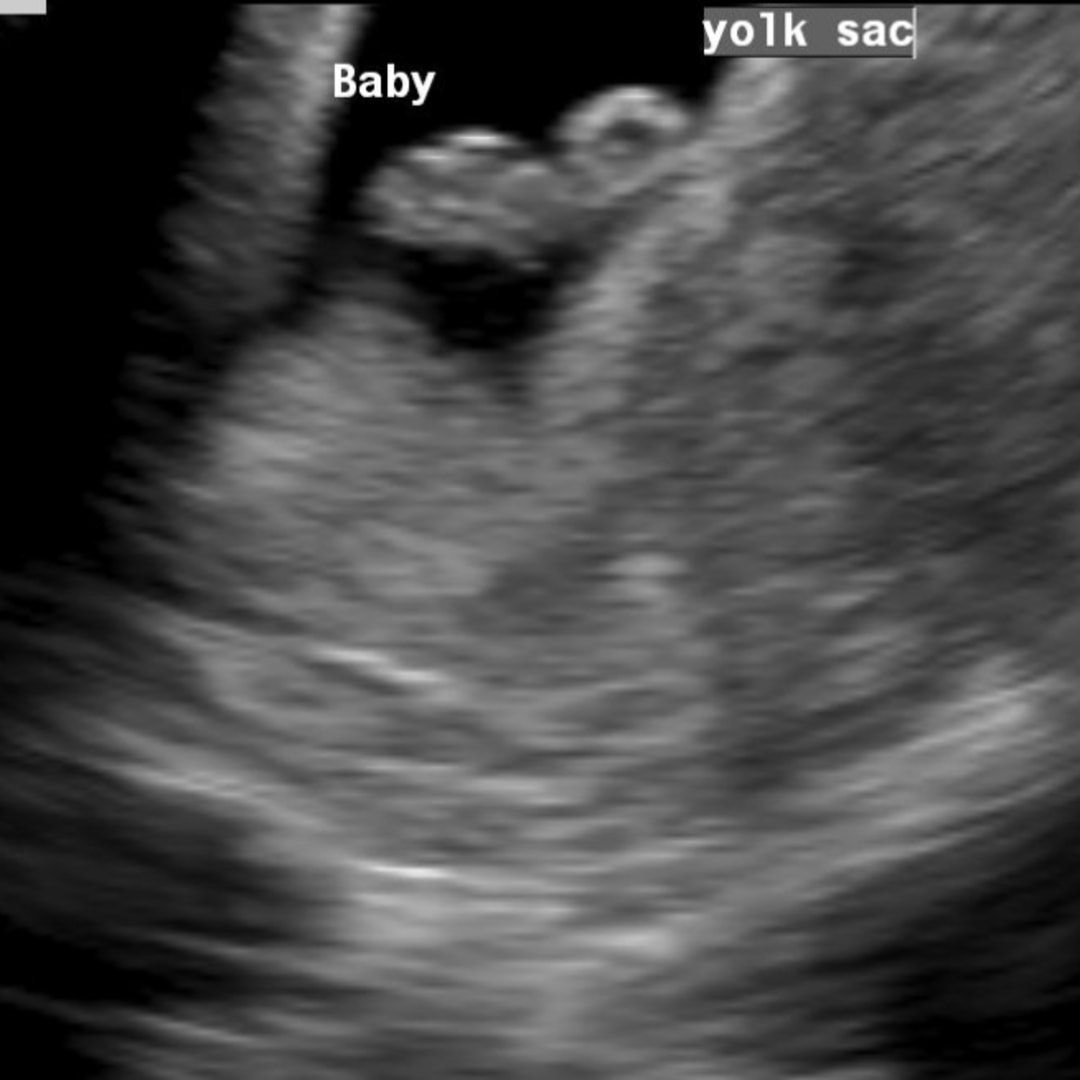 Photo shared by Madelyn for their Babylist baby registry.