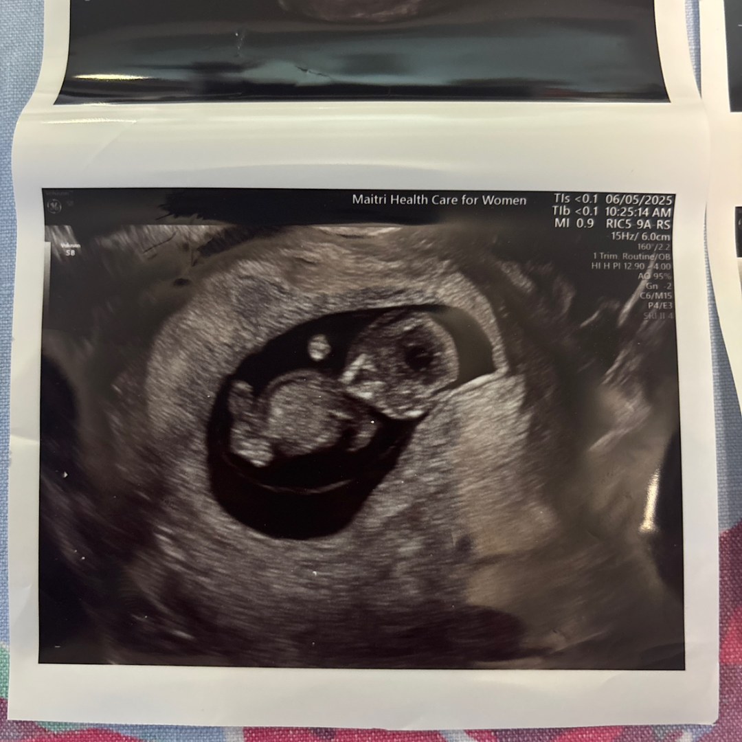 Photo shared by Lisa for their Babylist baby registry.