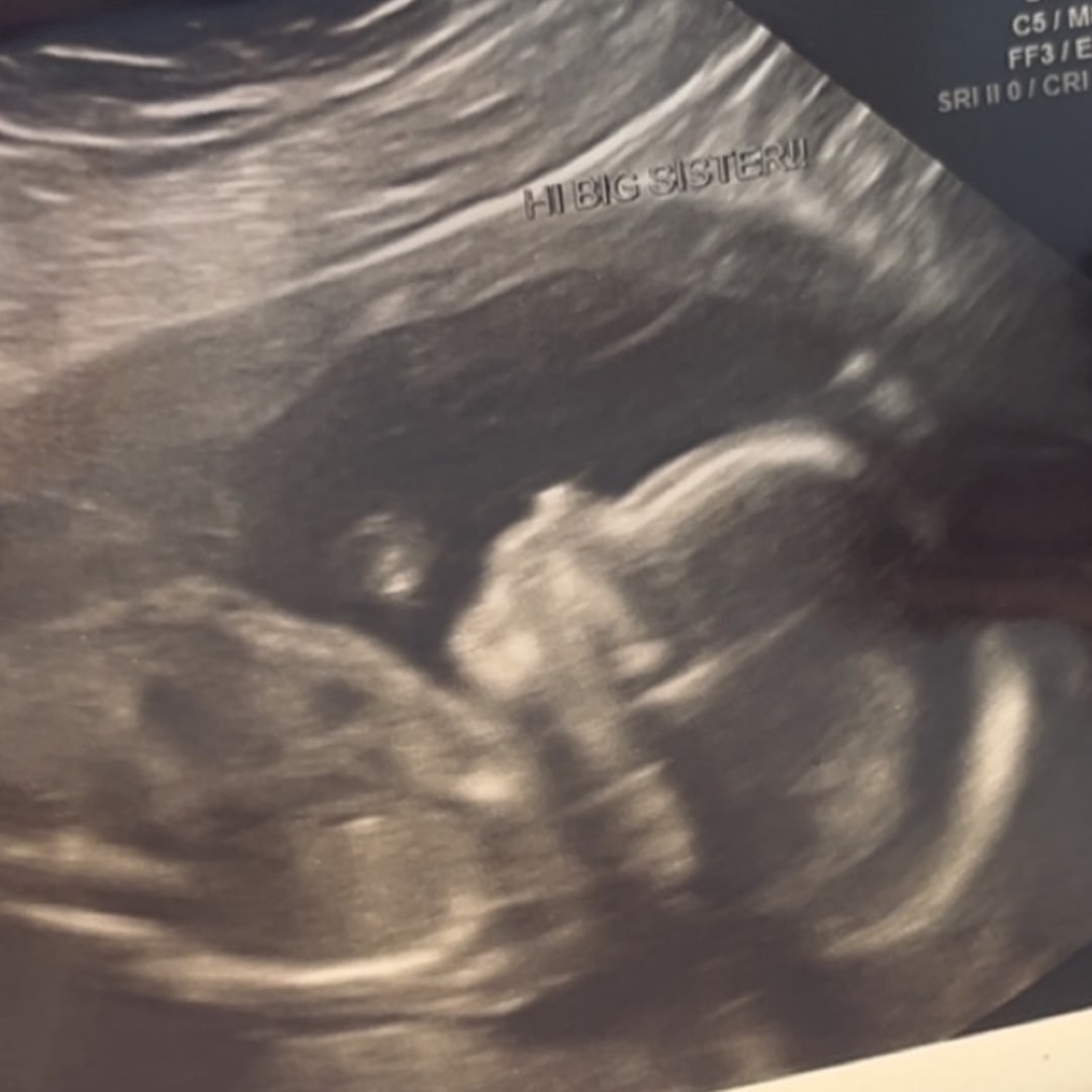 Photo shared by Chelsey for their Babylist baby registry.