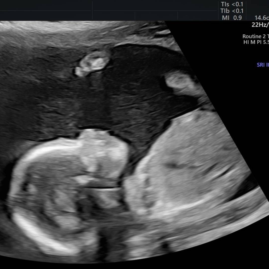 Photo shared by Kim for their Babylist baby registry.