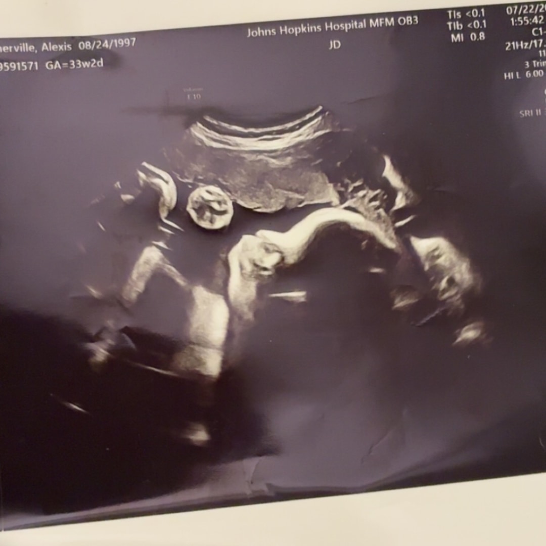 Photo shared by Alexis for their Babylist baby registry.