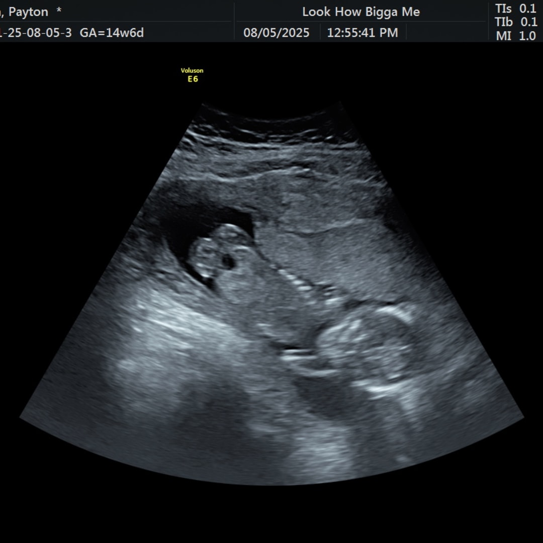 Photo shared by Payton for their Babylist baby registry.