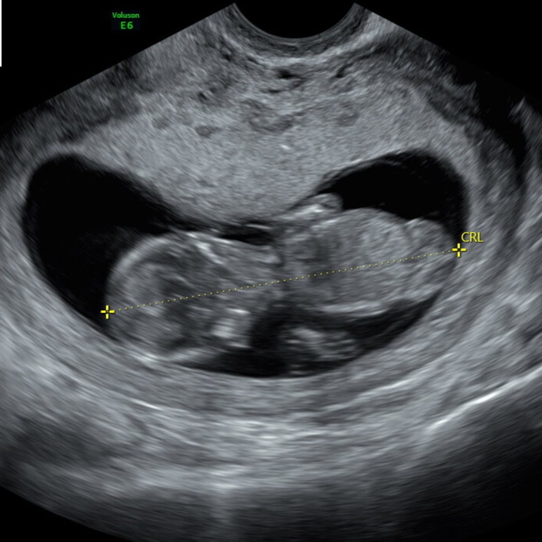 Photo shared by Sabrina for their Babylist baby registry.