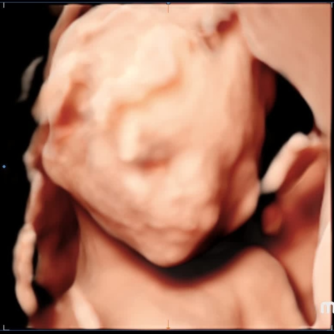 Photo shared by Cassie for their Babylist baby registry.