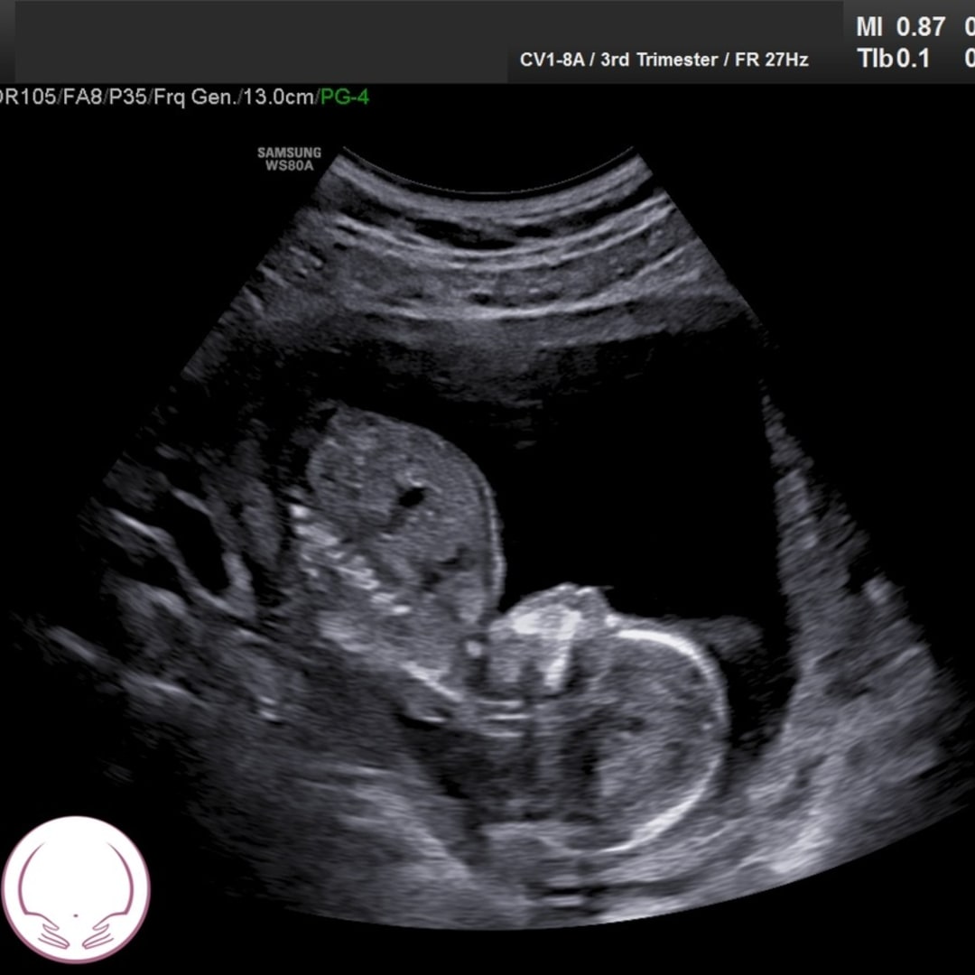 Photo shared by Hope for their Babylist baby registry.