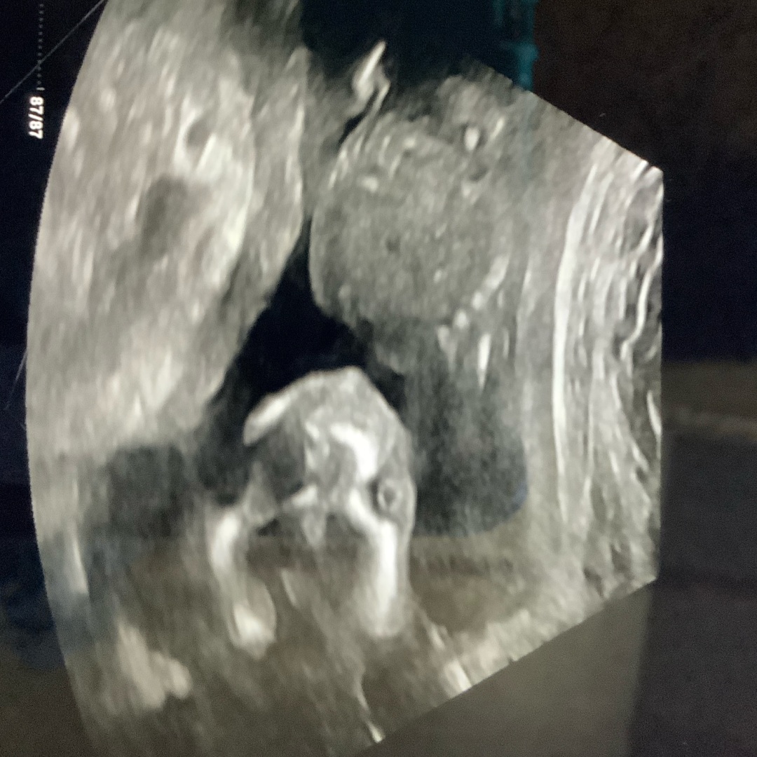 Photo shared by Zachary for their Babylist baby registry.