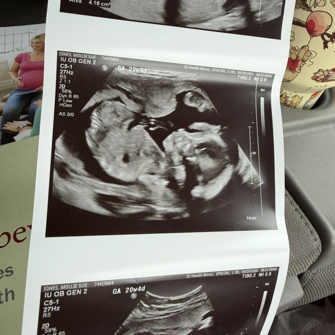 Photo shared by Mollie for their Babylist baby registry.