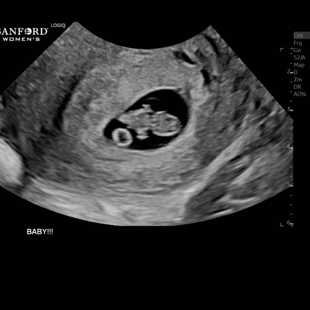 Photo shared by Stephanie for their Babylist baby registry.