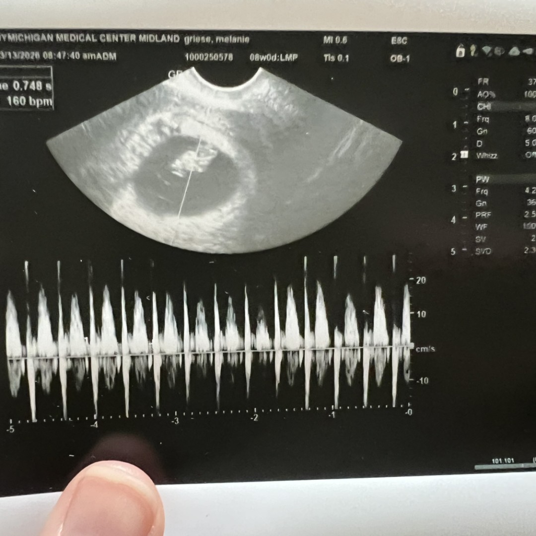Photo shared by Mel for their Babylist baby registry.
