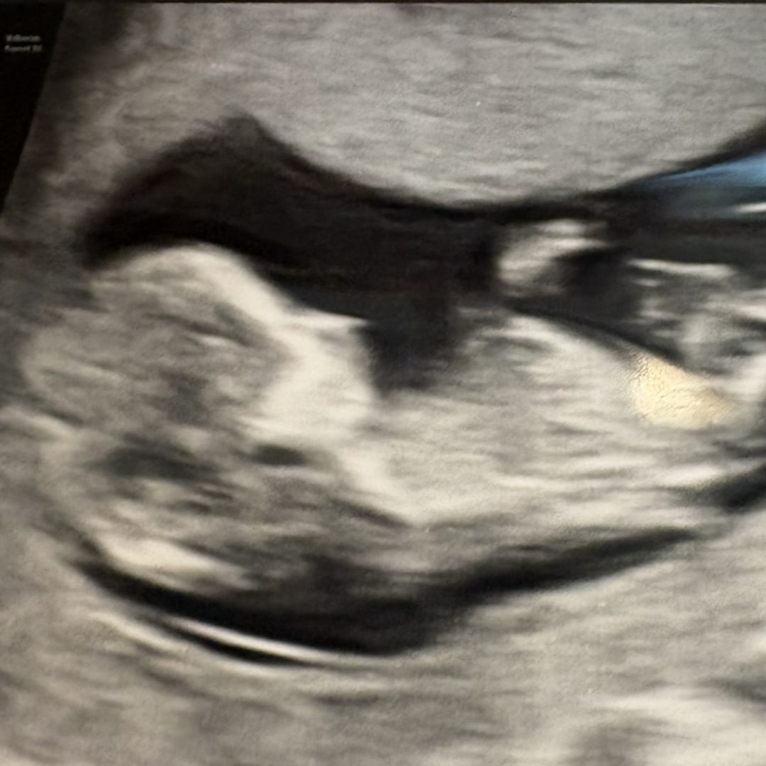 Photo shared by Rebecca for their Babylist baby registry.