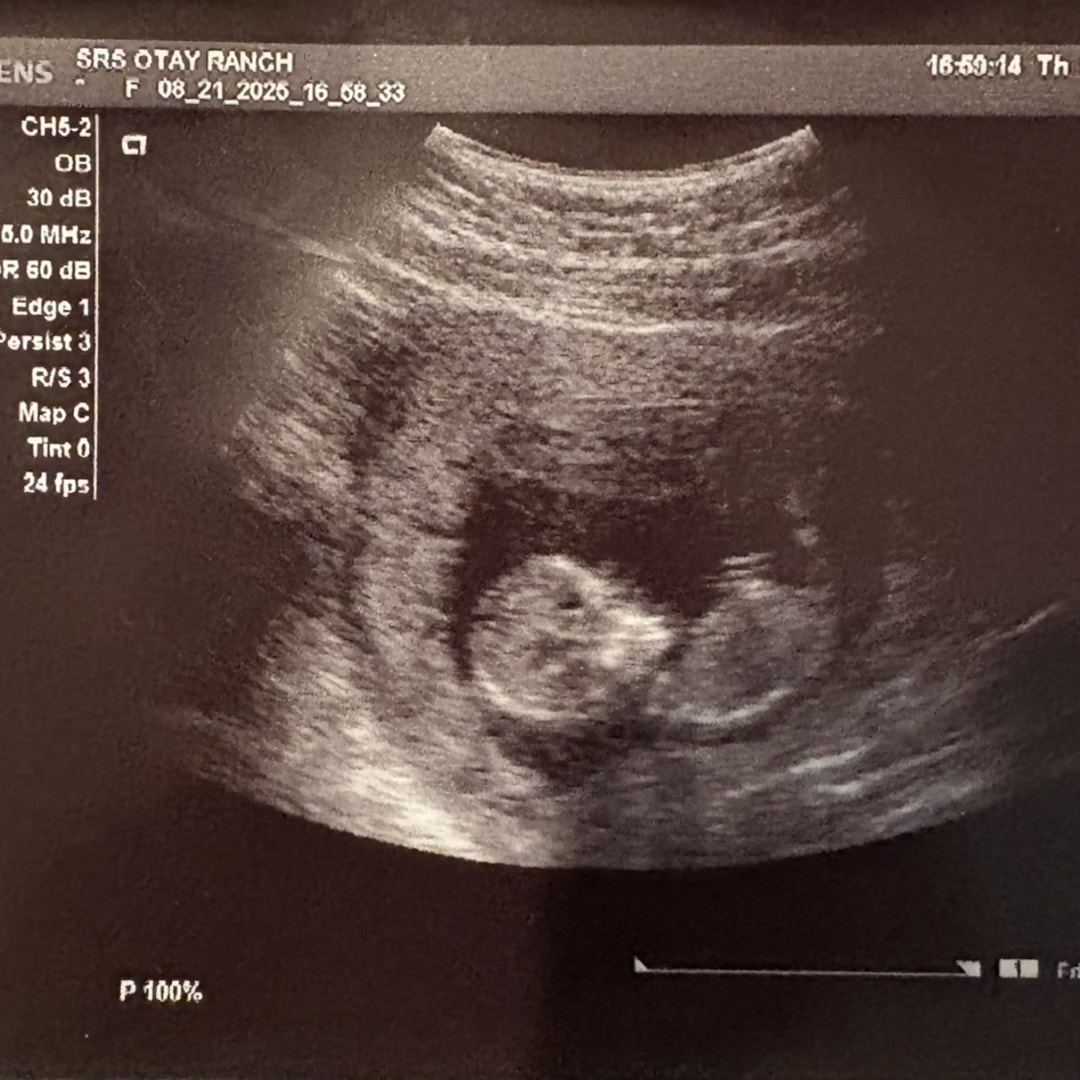 Photo shared by Sophia for their Babylist baby registry.