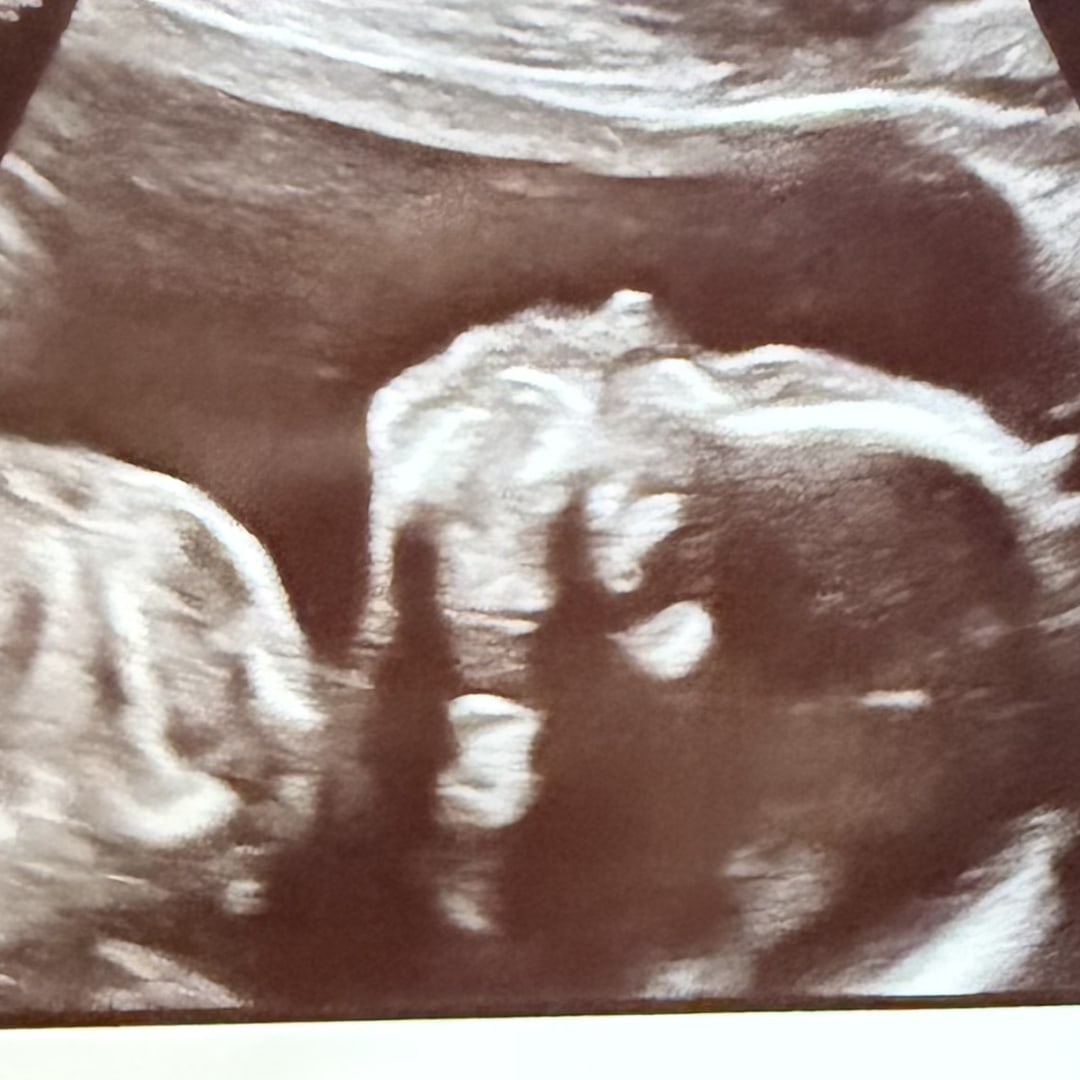 Photo shared by Olga for their Babylist baby registry.
