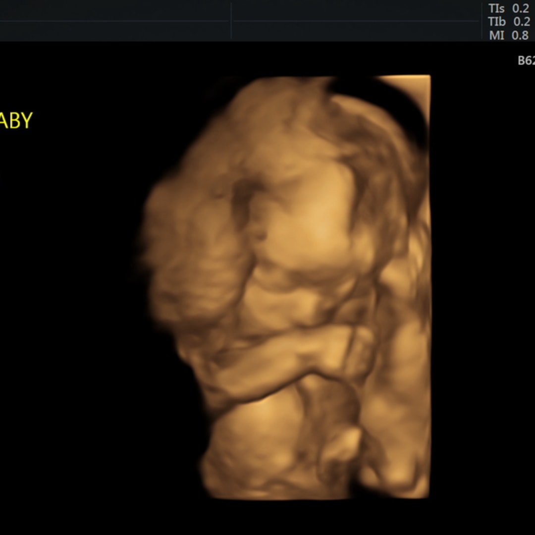 Photo shared by Alexa for their Babylist baby registry.
