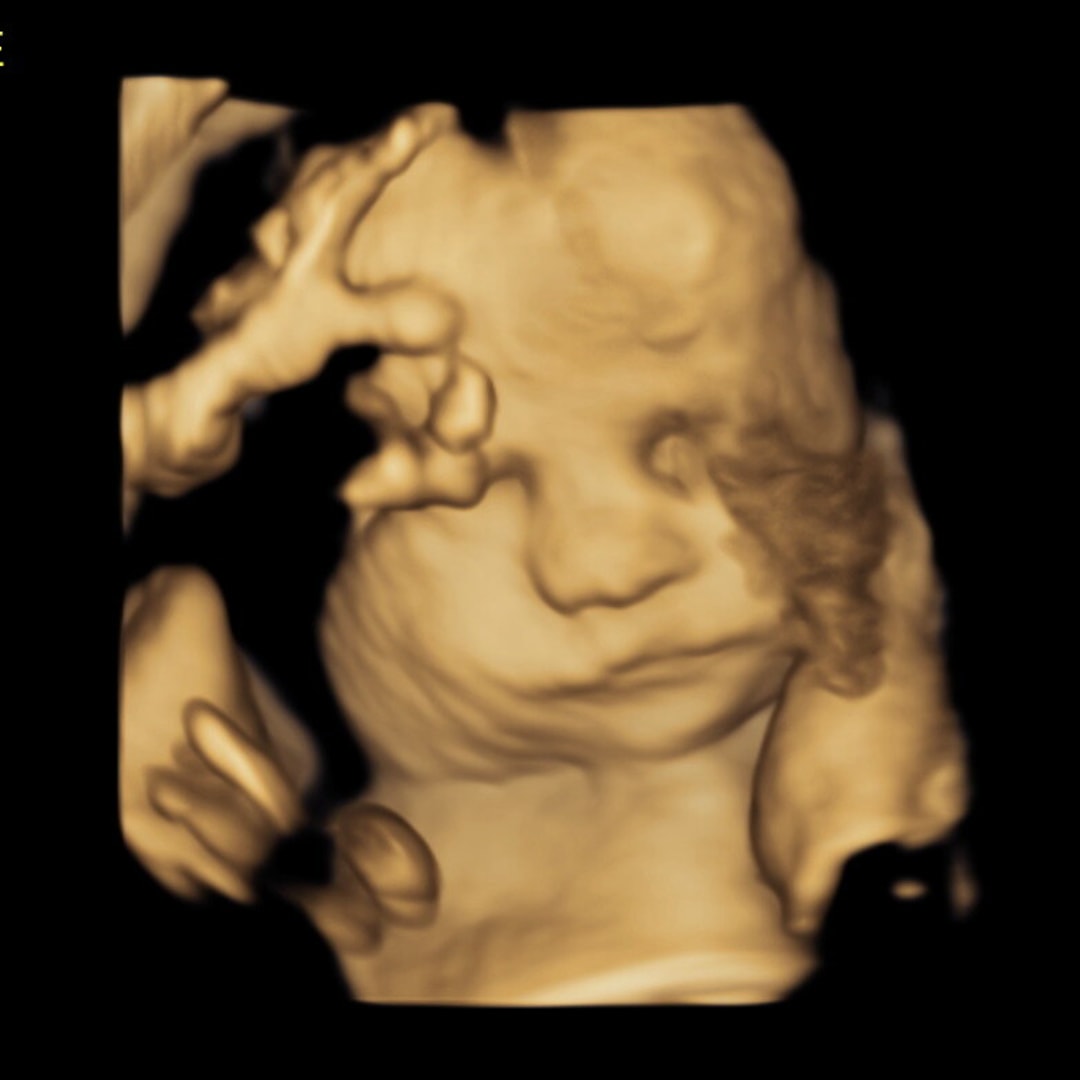 Photo shared by Jennifer for their Babylist baby registry.