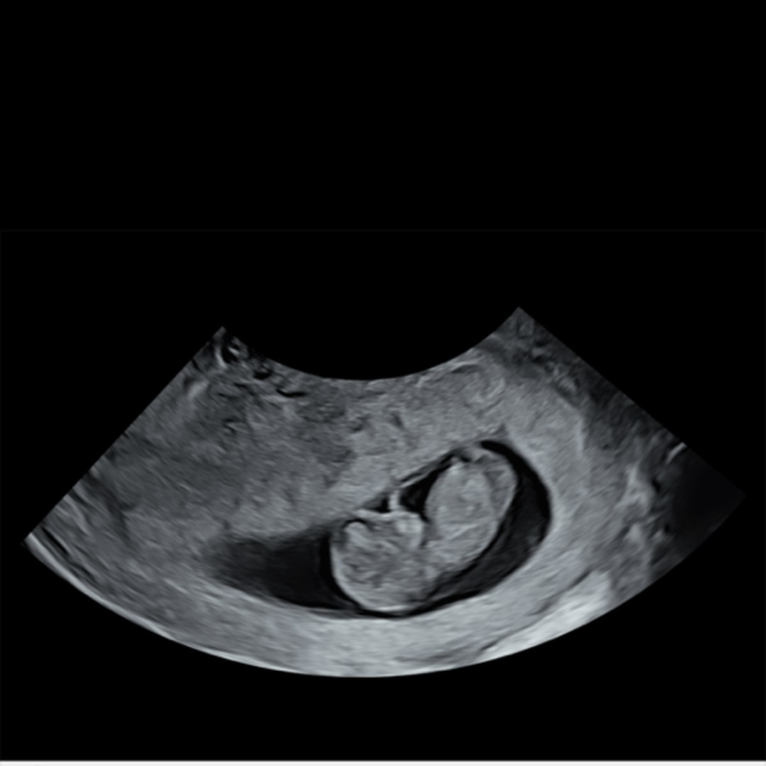 Photo shared by Carla for their Babylist baby registry.