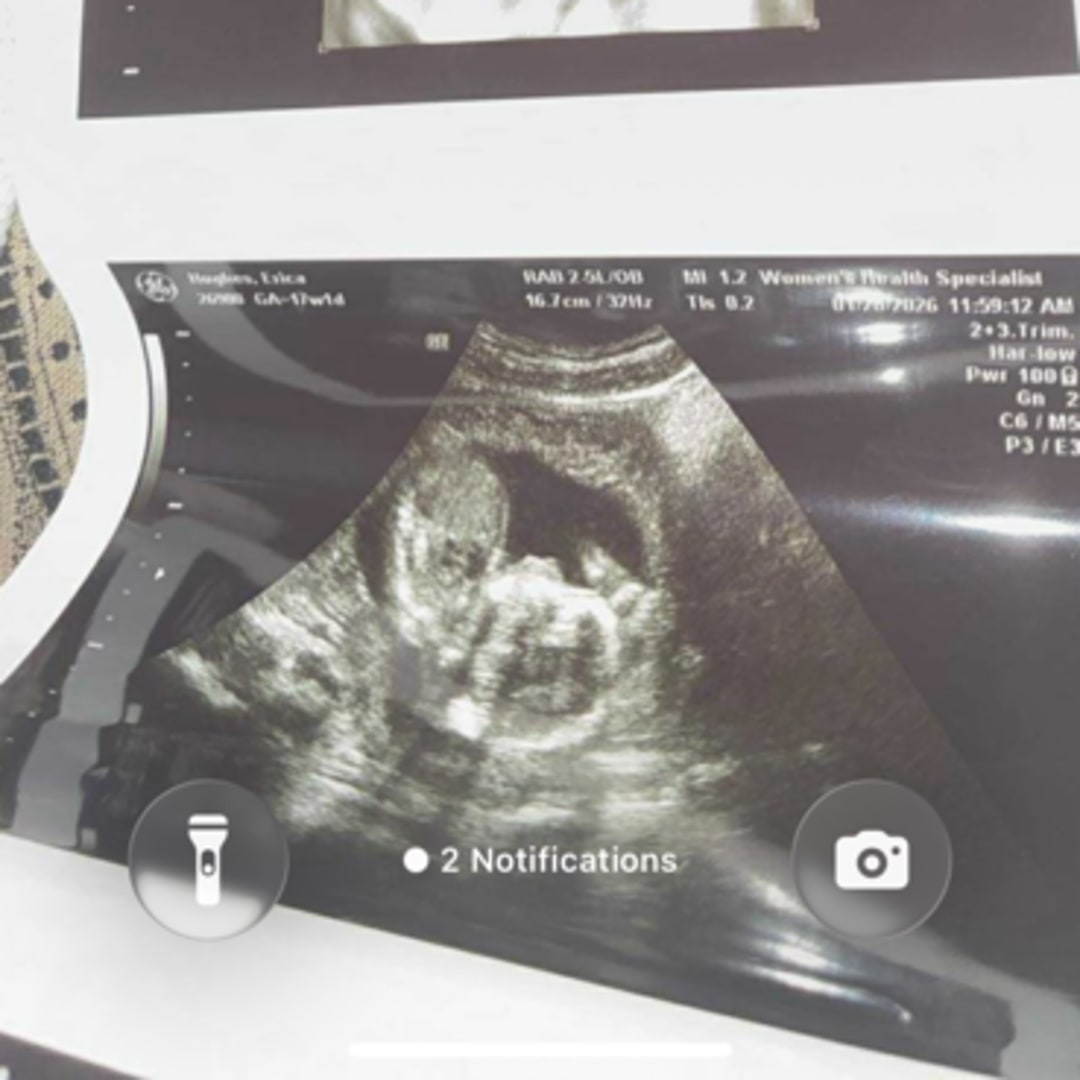 Photo shared by Erica for their Babylist baby registry.