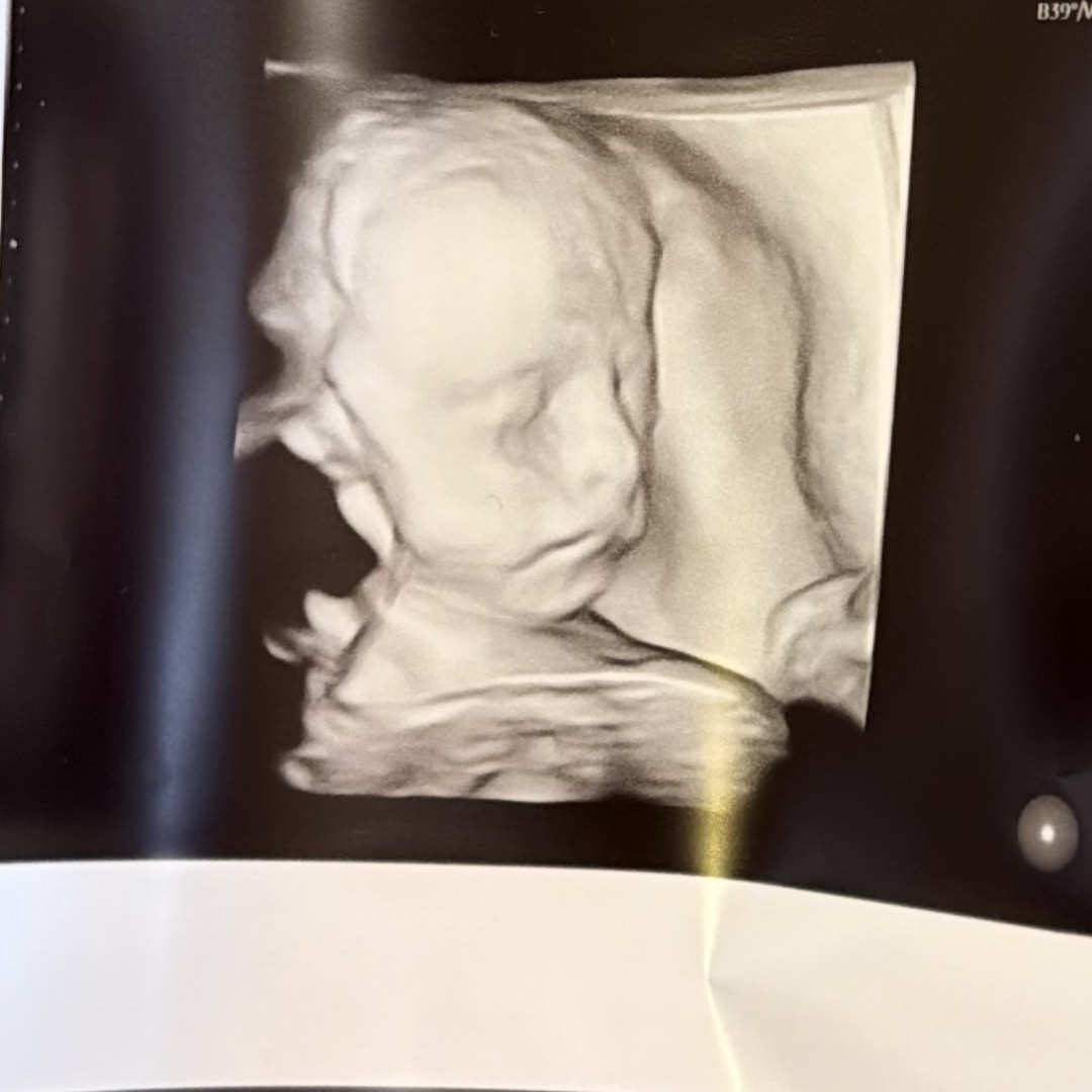 Photo shared by Aujanae for their Babylist baby registry.