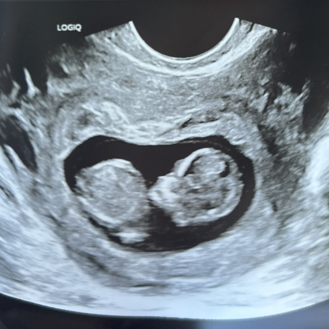 Photo shared by Jessica for their Babylist baby registry.