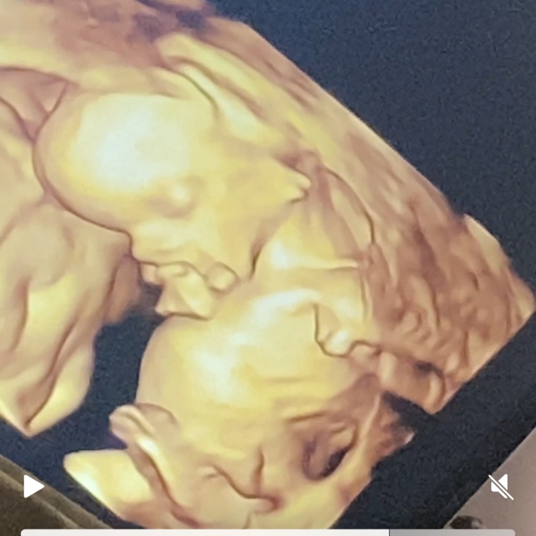 Photo shared by Kevon for their Babylist baby registry.