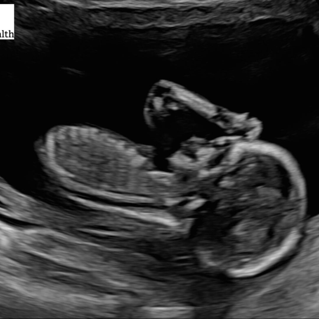 Photo shared by Maggie for their Babylist baby registry.