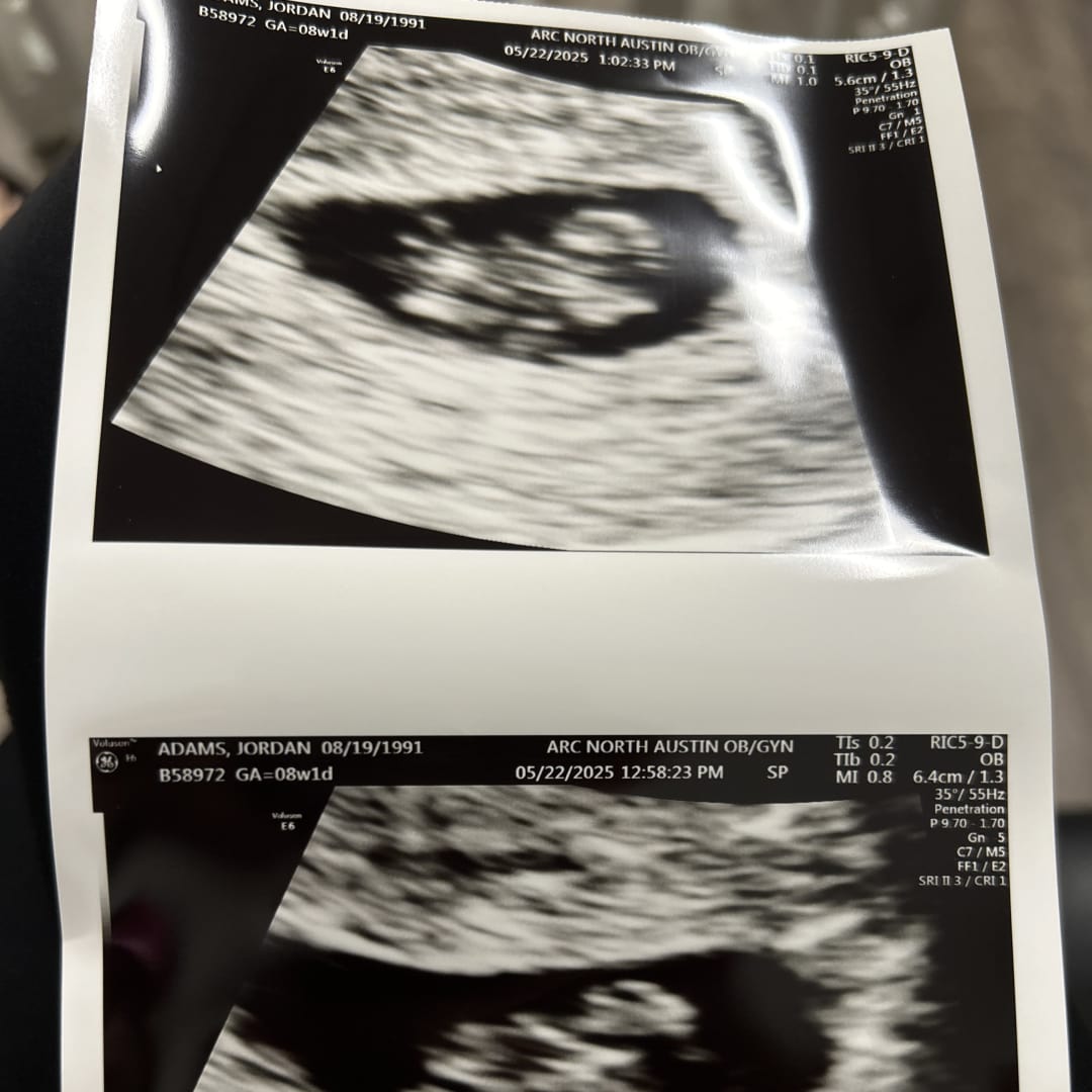 Photo shared by Jordan for their Babylist baby registry.