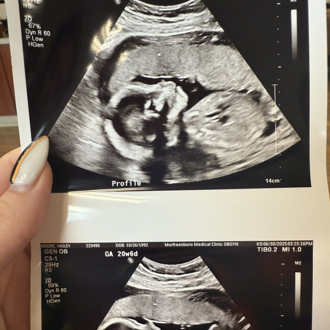 Photo shared by Hailey for their Babylist baby registry.