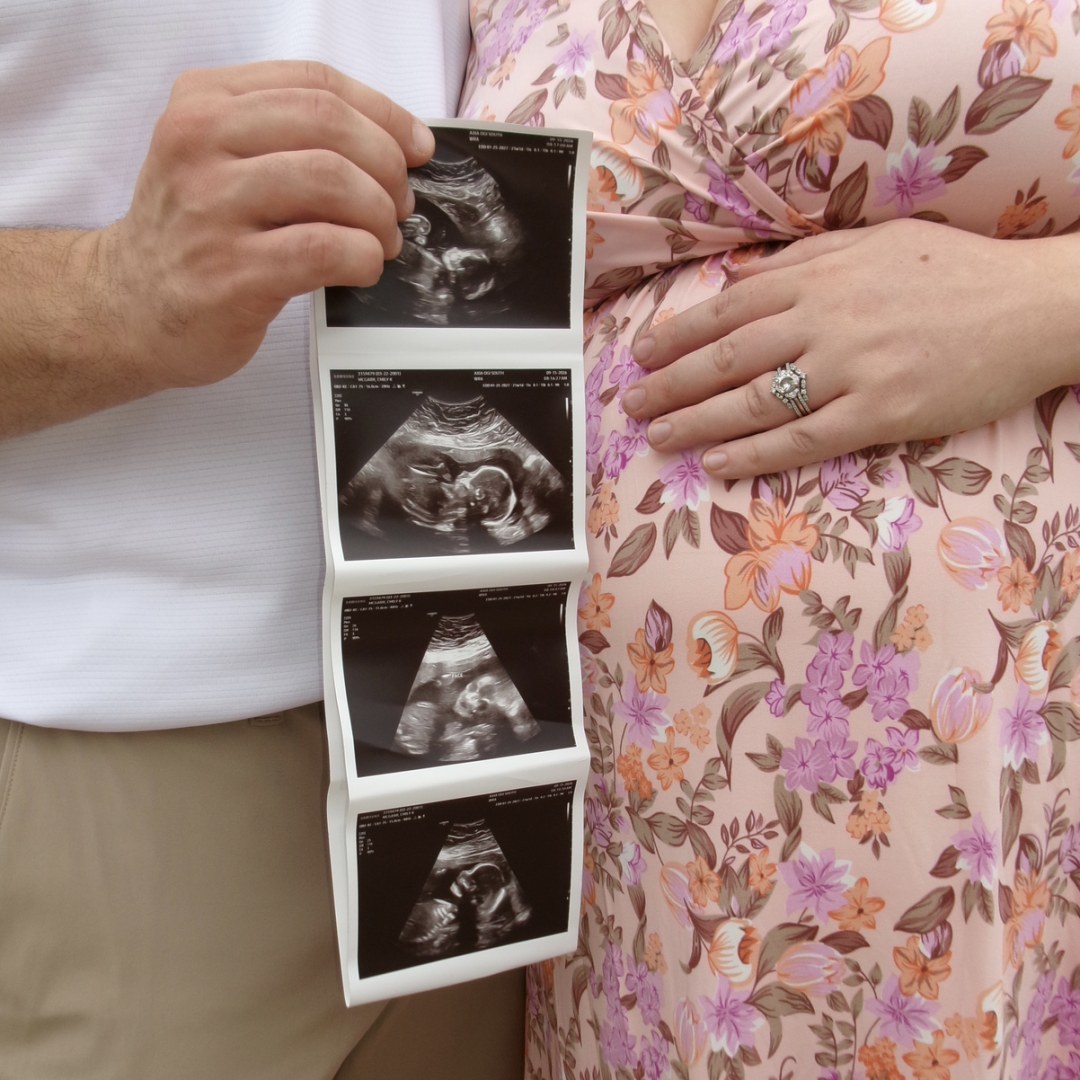 Photo shared by Emily for their Babylist baby registry.