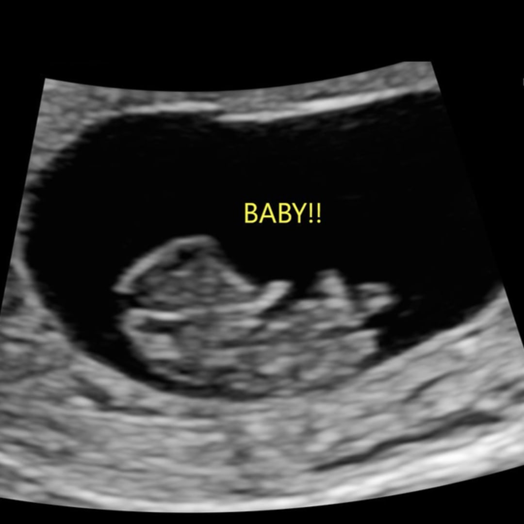 Photo shared by Lila for their Babylist baby registry.