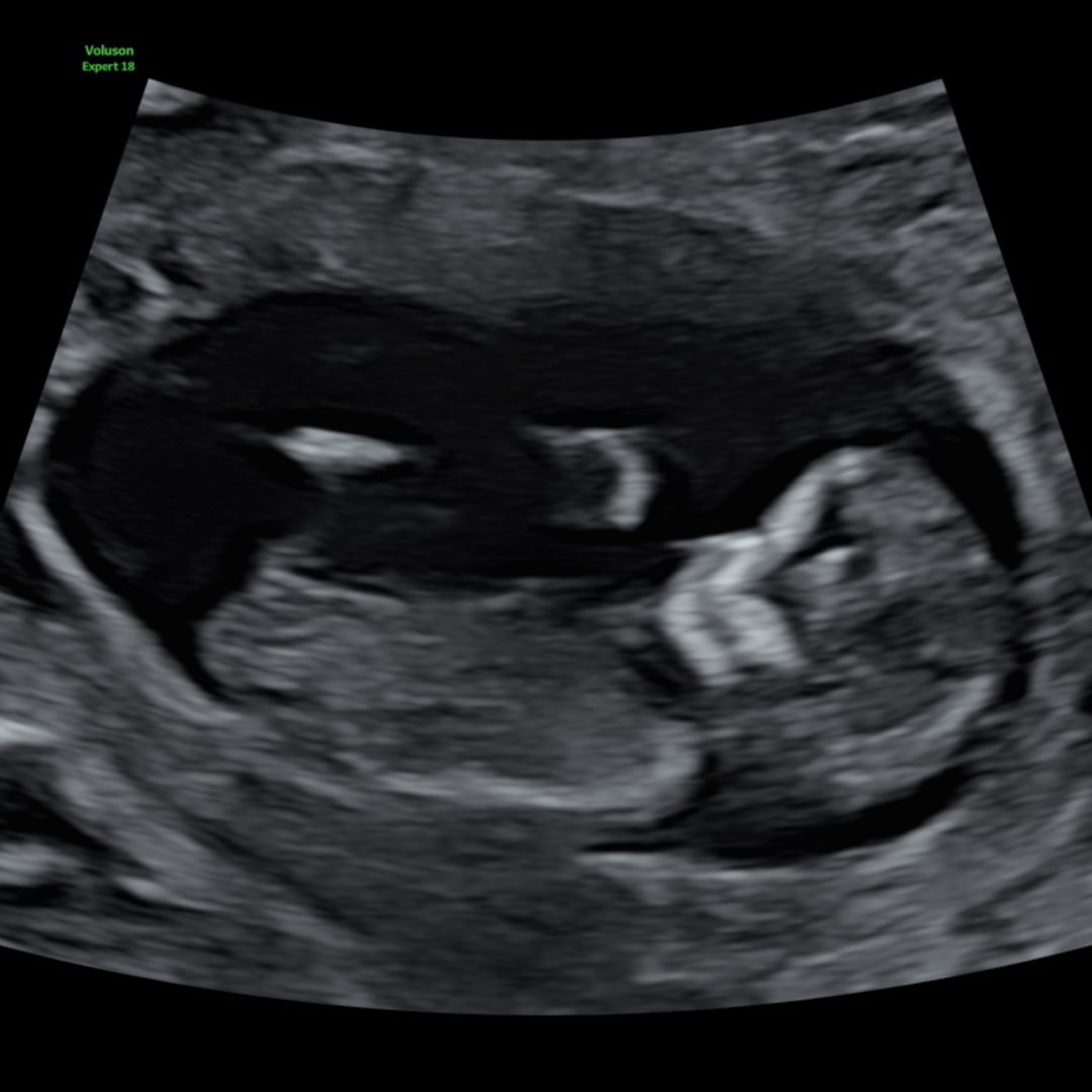 Photo shared by Abigail for their Babylist baby registry.