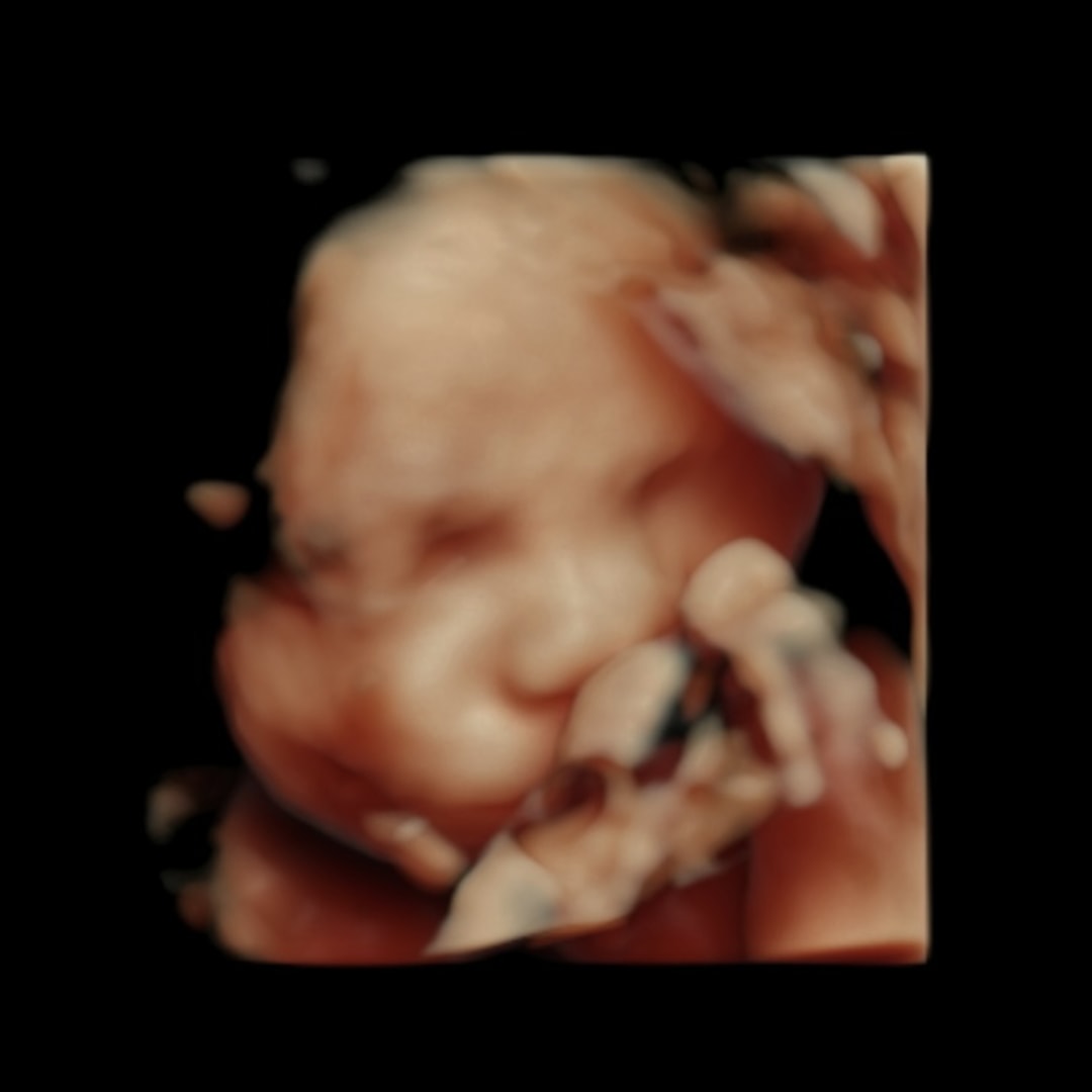 Photo shared by Katy for their Babylist baby registry.