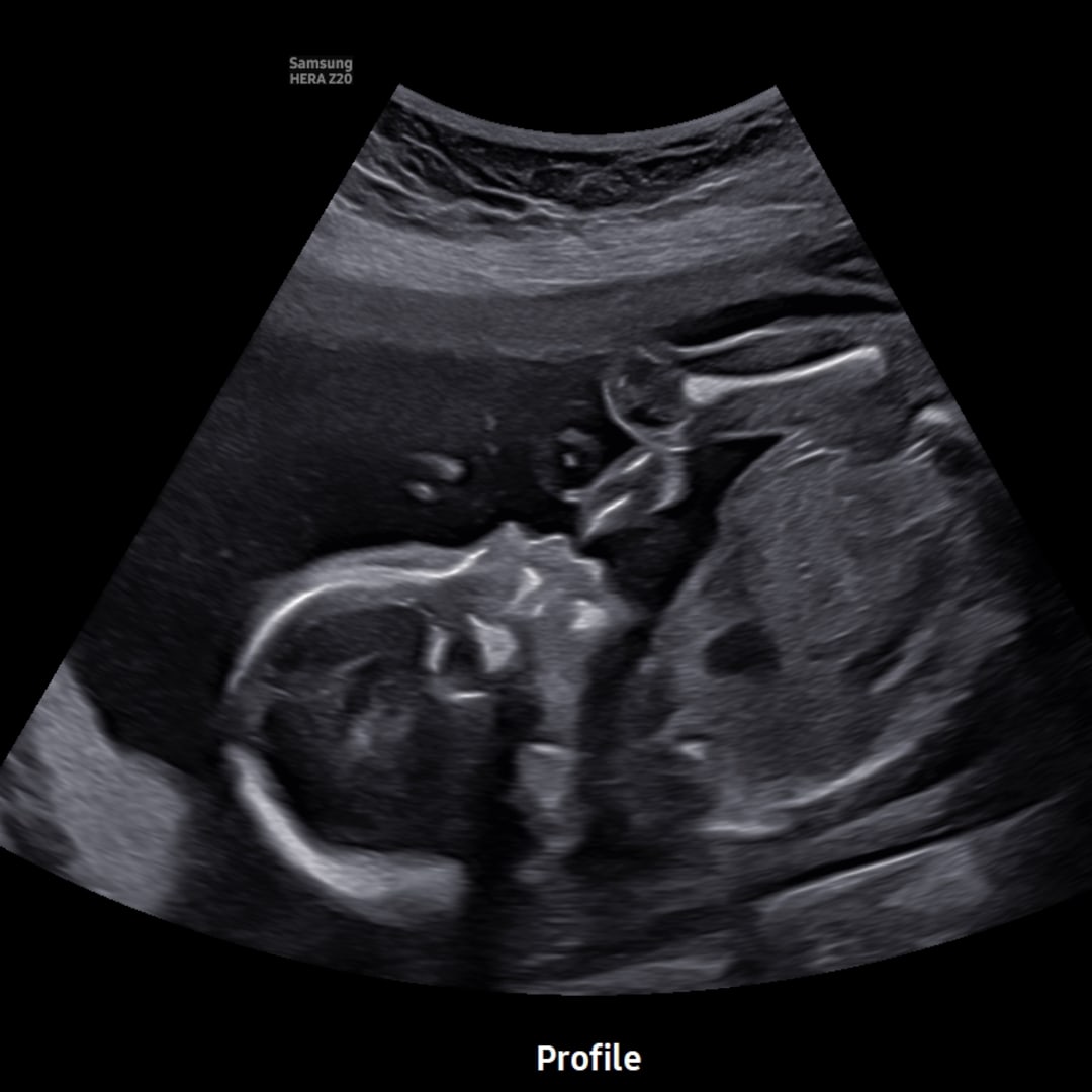 Photo shared by Hannah for their Babylist baby registry.