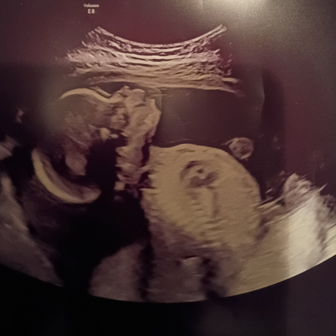 Photo shared by Janiya for their Babylist baby registry.