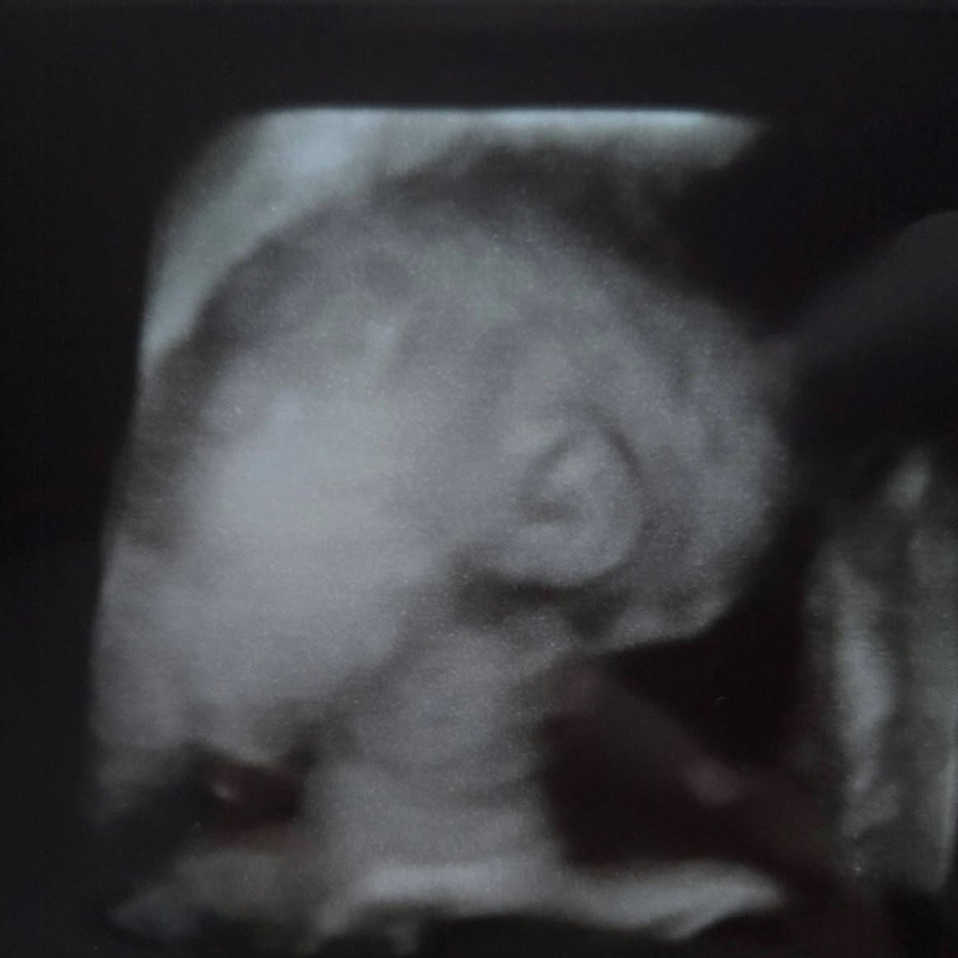 Photo shared by Ashley for their Babylist baby registry.