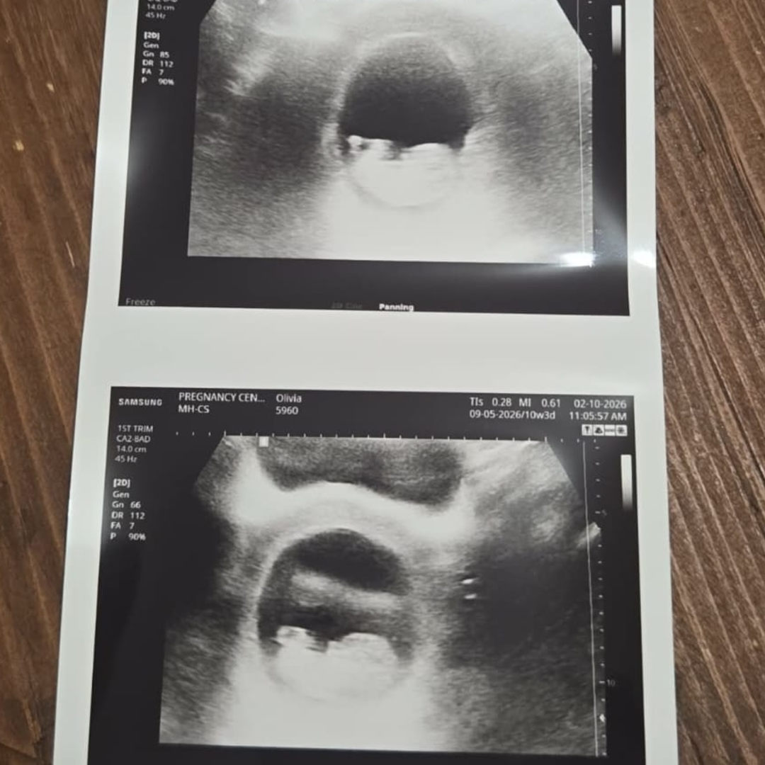 Photo shared by Olivia for their Babylist baby registry.