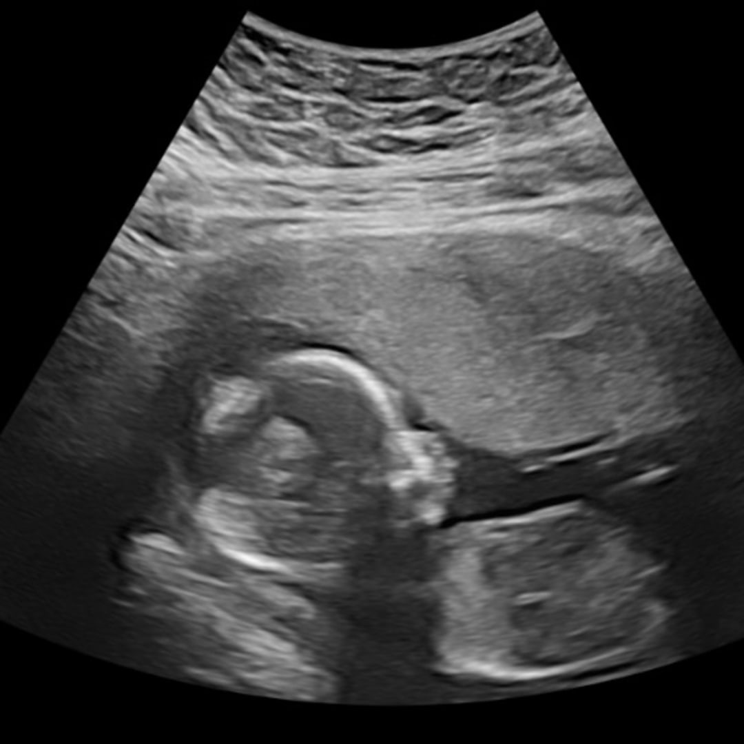 Photo shared by Abbey for their Babylist baby registry.