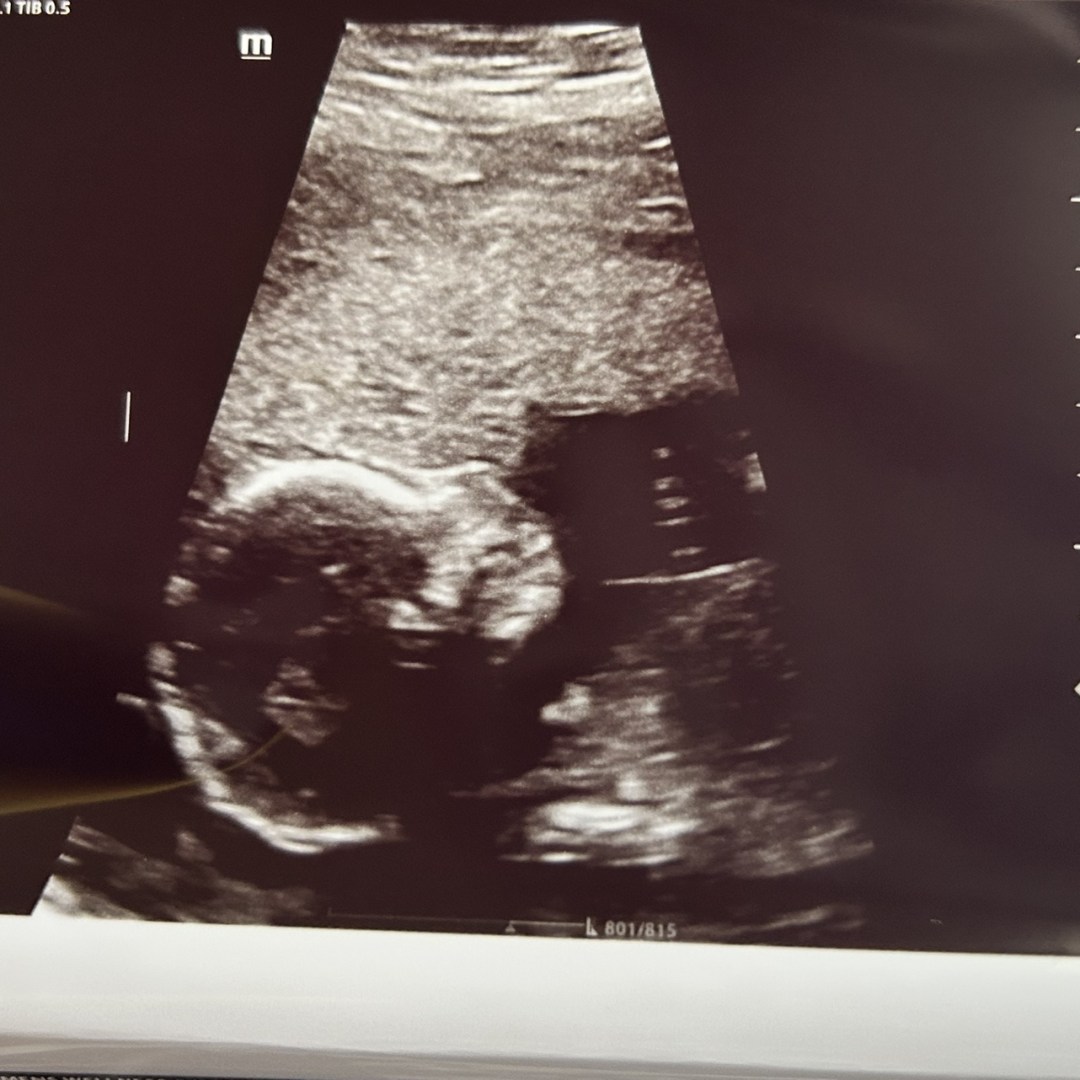 Photo shared by Laura for their Babylist baby registry.