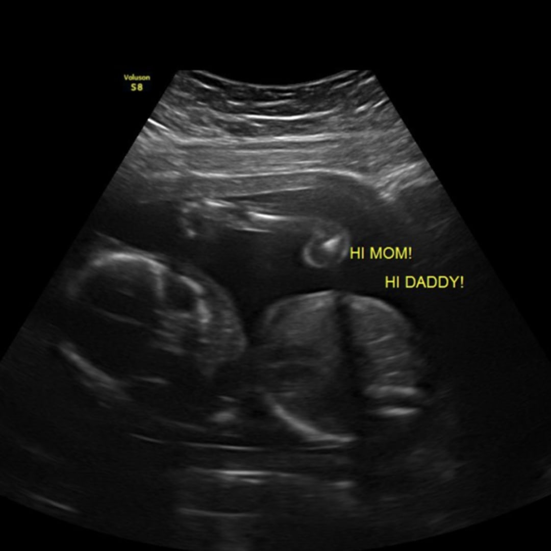 Photo shared by Desteny for their Babylist baby registry.