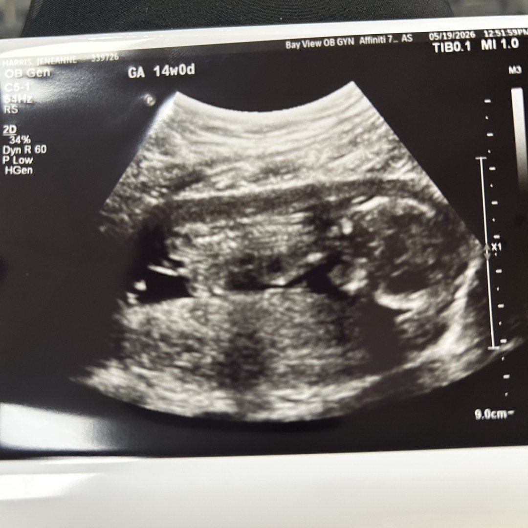 Photo shared by Gigi for their Babylist baby registry.