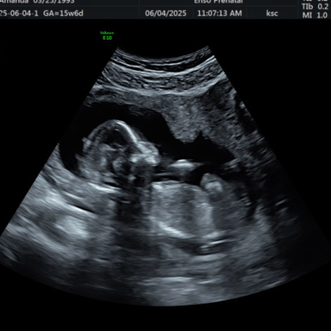 Photo shared by Amanda for their Babylist baby registry.