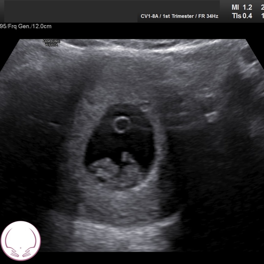 Photo shared by Natalie for their Babylist baby registry.