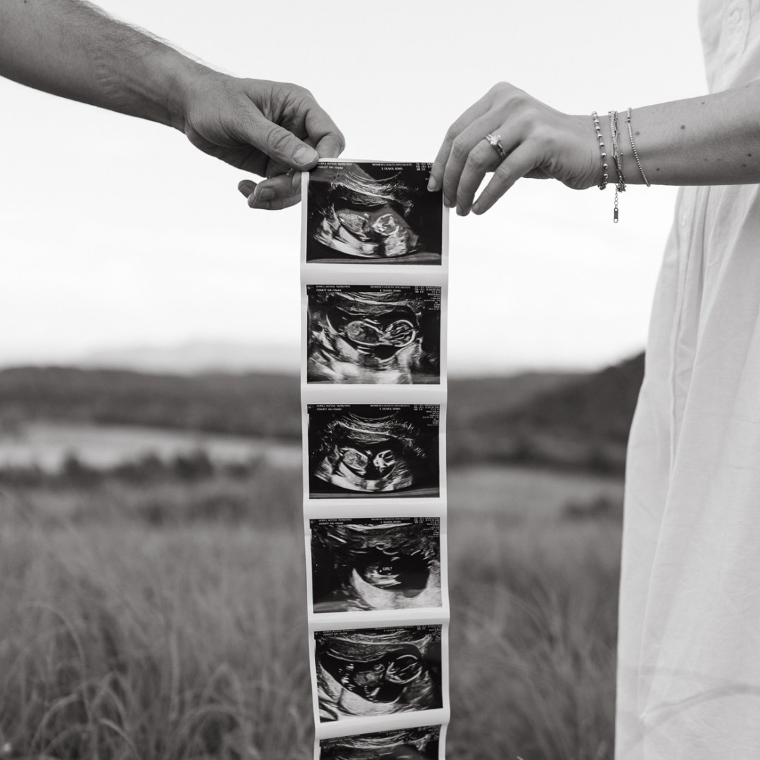 Photo shared by Alyssa for their Babylist baby registry.