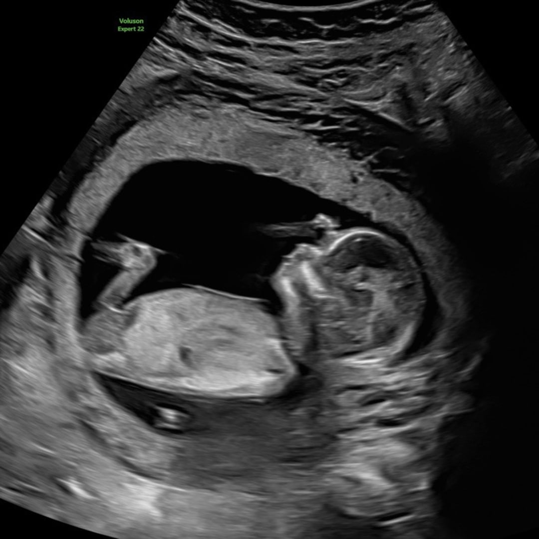 Photo shared by Rachel for their Babylist baby registry.