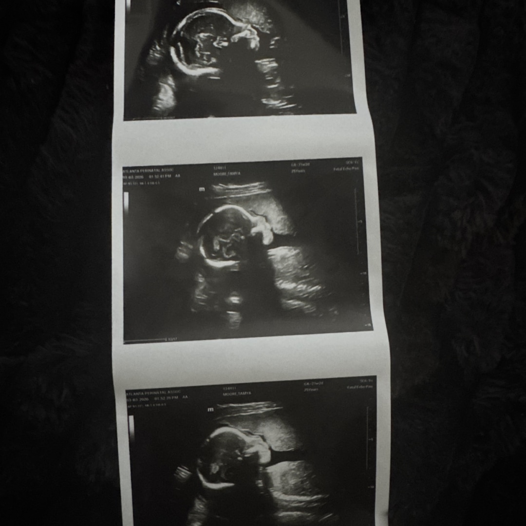 Photo shared by Tamya for their Babylist baby registry.