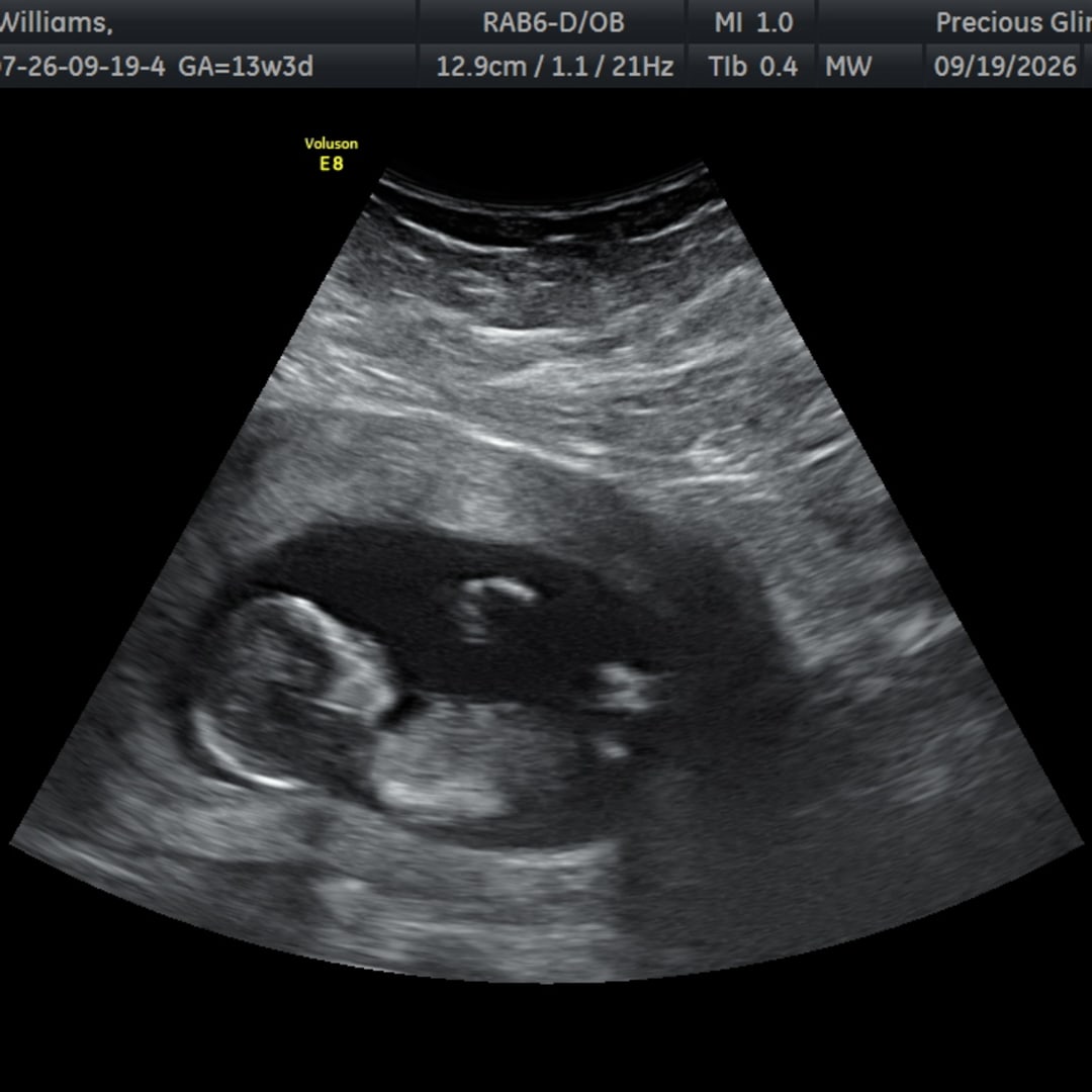 Photo shared by Makenzie for their Babylist baby registry.