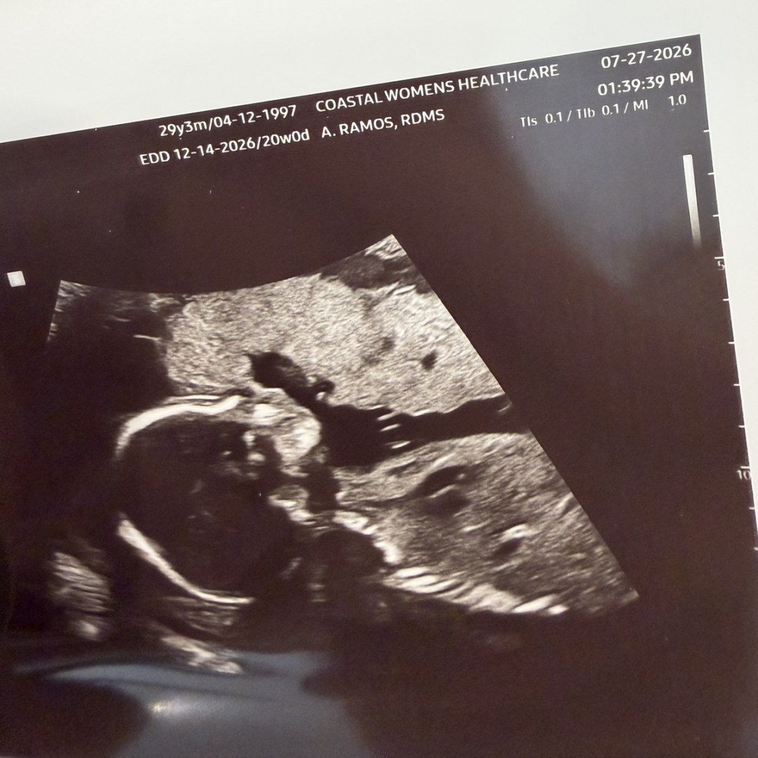 Photo shared by Saoirse for their Babylist baby registry.
